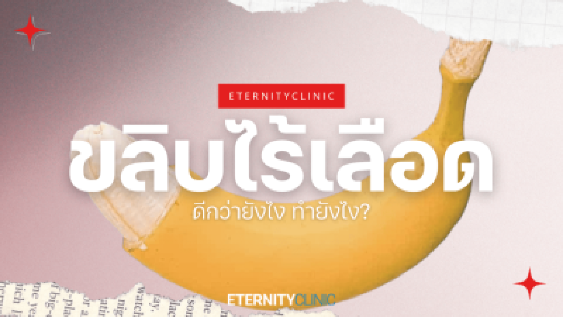 ขลิบไร้เลือดดีกว่ายังไง ทำยังไง