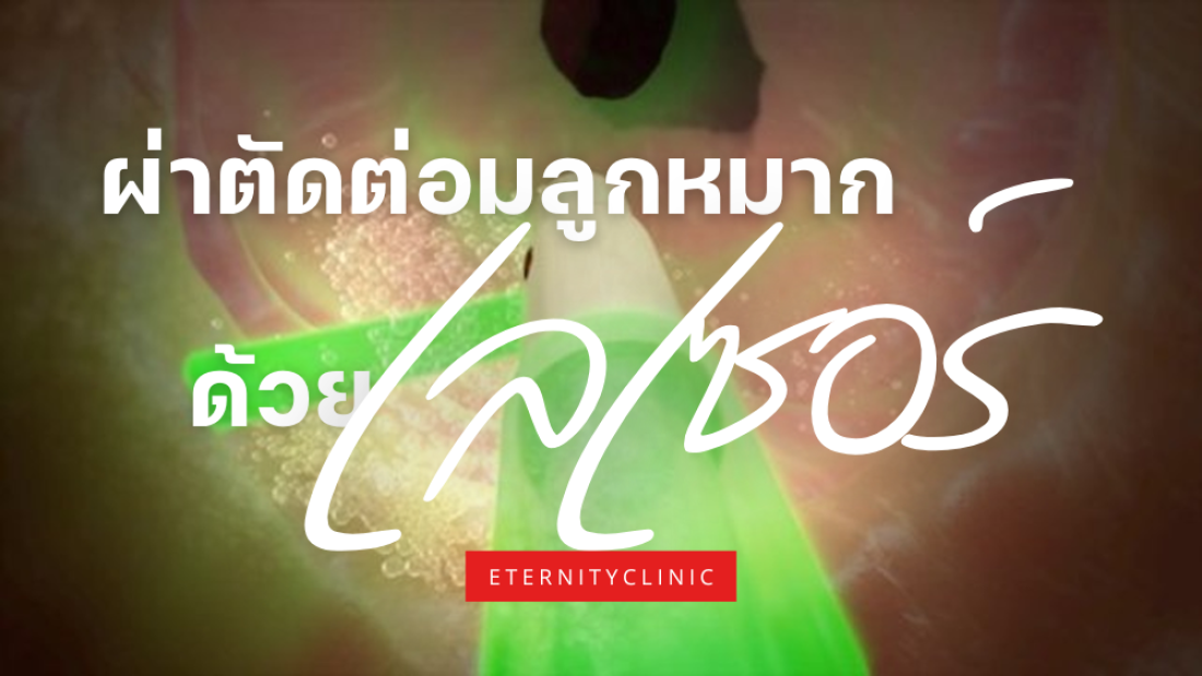 ต่อมลูกหมากโต วิธีการรักษา การผ่าตัดต่อมลูกหมากด้วย Laser