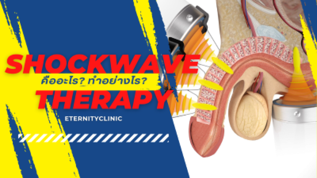 อวัยวะเพศไม่แข็งตัว ทำอย่างไรได้บ้าง shockwave therapy คืออะไร